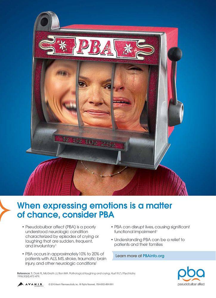 Pseudobulbar_Affect_PBA_Avanir-PsychiatricNews-October2010.jpg