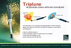 Triplane-BK_Medical-UrologyNews-Pinpoint-JanuaryFebruary2011.jpg