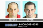 Bosley-Hair_Loss-dtcusa-June2011-1920X1080-60s.mp4
