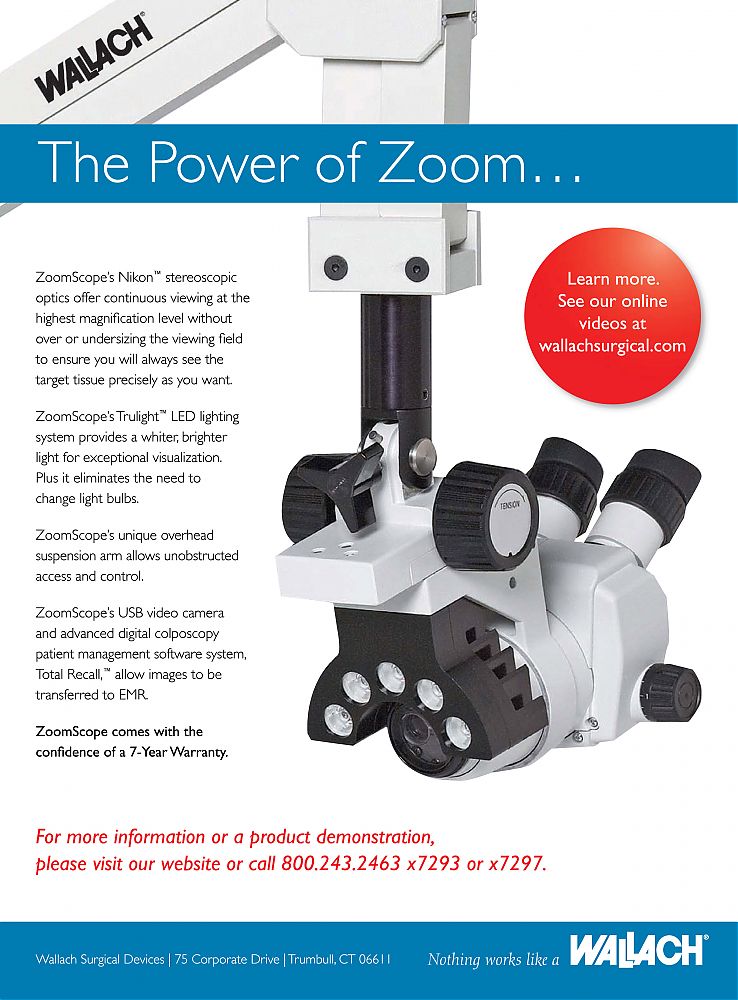 Wallach-Zoomscope_Nikon-eye_care-ophthalmology-ContemporaryOBGYN-June2010.jpg