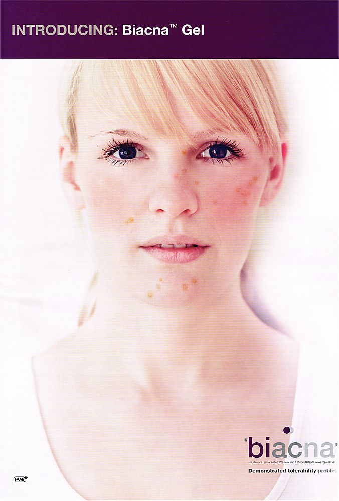 Biacna_Gel-Acne-Valeant-Dermatology-1-TheChronicleOfSkinAndAllergy-August2011.jpg