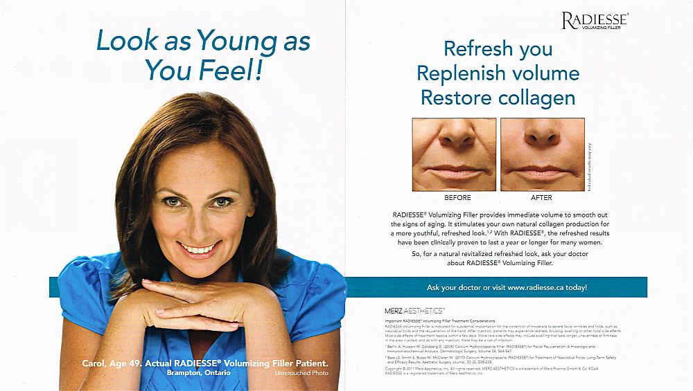 Radiesse-hcpCanada-November2011.jpg