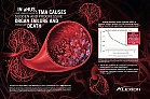 Alexion_brand-May2013-hcpUSA.jpg