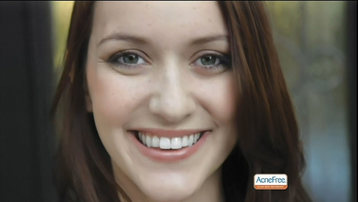 Acne_Free-47695-dtcUSA.mp4