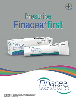 Finacea-50436-hcpUSA.jpg