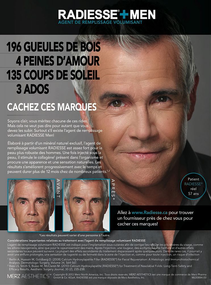 Radiesse_LePatient-July2014_hcpCanada_SP.jpg