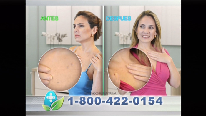 SaniSkin_Galavision-May112015_dtcUSA.mp4