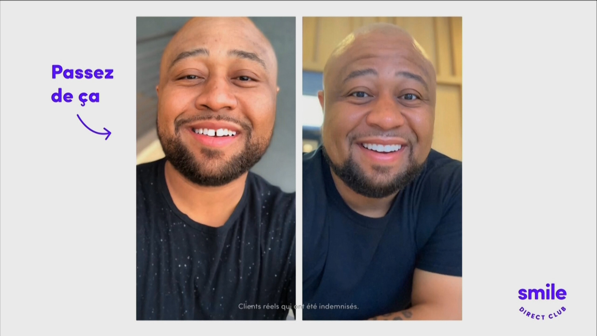 Smile_Direct_Club---kw---Healthcare_category---ICIRDI_-_January_18--2020---dtc---Canada---French---TV_commercial---30_seconds.mp4