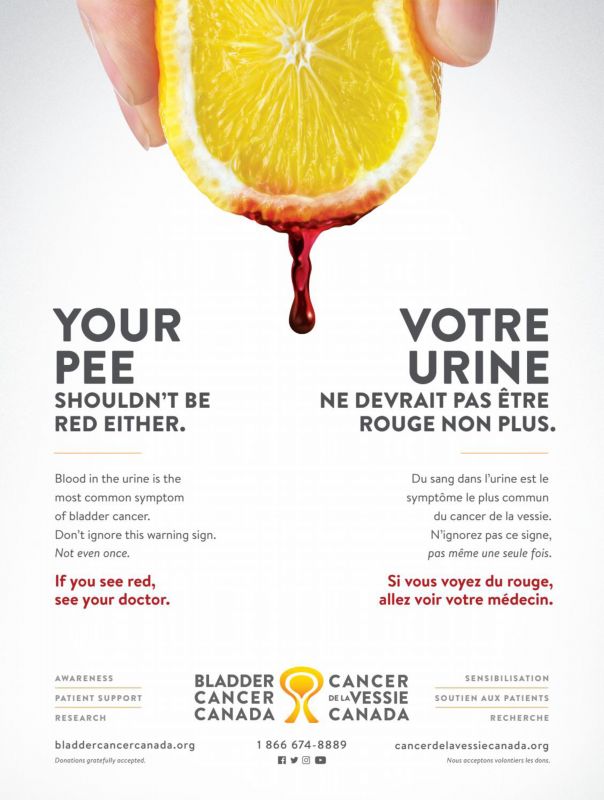 Bladder_Cancer_Canada---kw---Healthcare_category---Montreal_en_sante_-_Vol_13_-_No_3_-_Summer_2021---dtc---Canada---English--French---Print_Ad---pSP.jpg