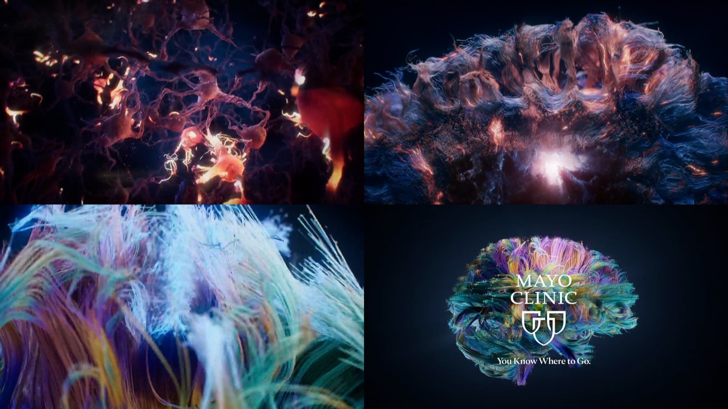Mayo_Clinic---Brain---Healthcare_category---Cbs_4_-_Denver_Co_-_October_22--2021---dtc---USA---English---TV_commercial---30_seconds.mp4